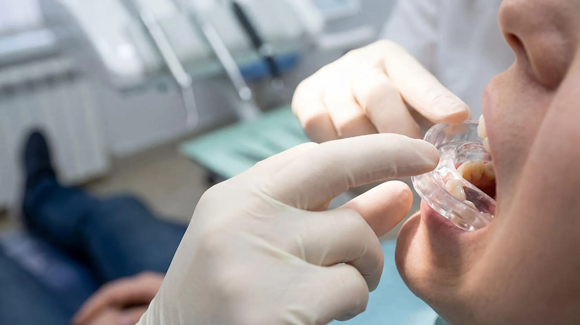 Dentist fitting new mouth guard in patient
