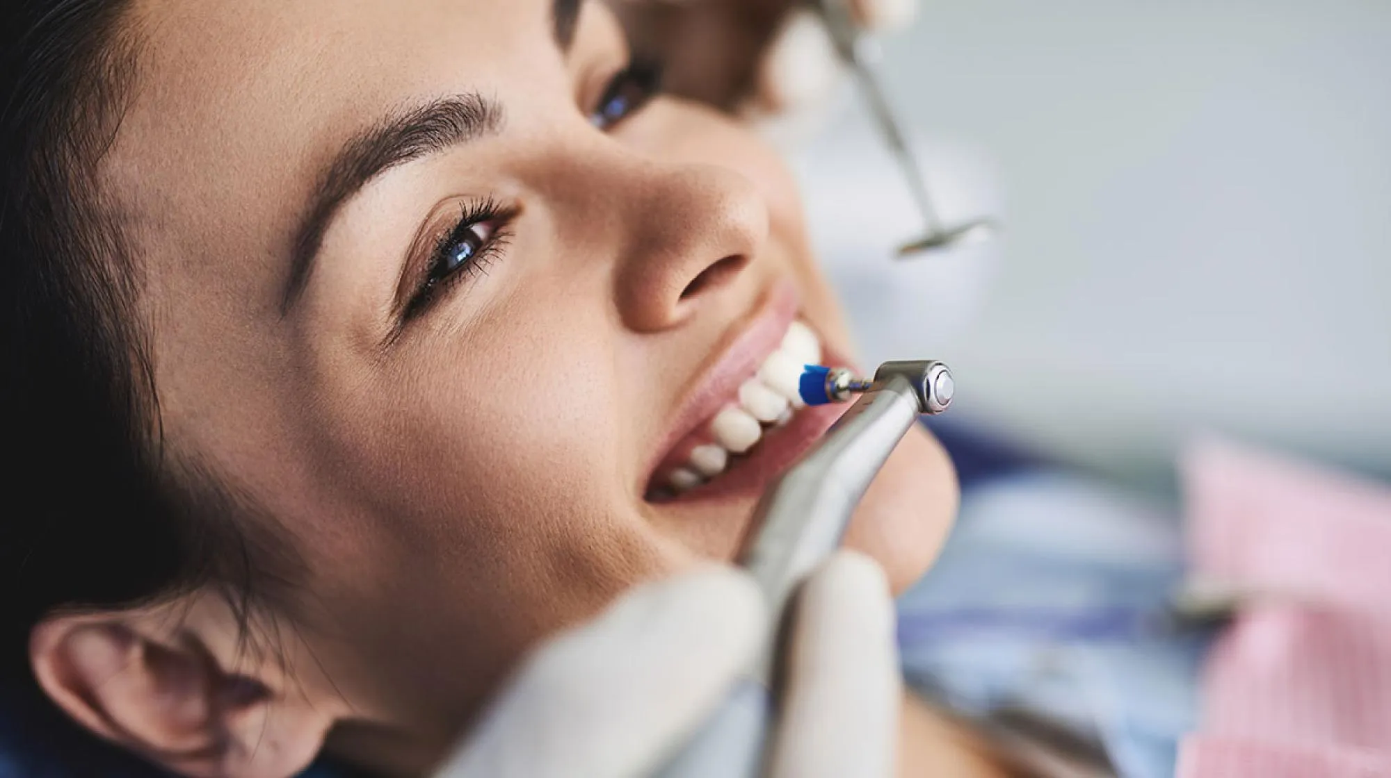 Dental cleaning at AltaVia Dental